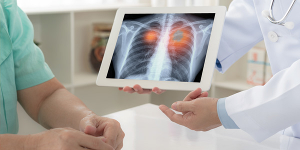 Physicians looking at a scan of the lung
