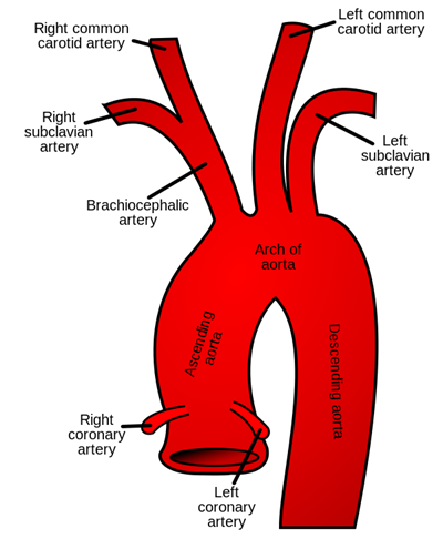 Aortic Arch Conditions